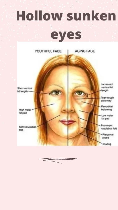 Face Aging, Workout Book, Sunken Eyes, Tear Trough, Nasolabial Folds, Face Yoga, Eye Area, Full Set, Work On