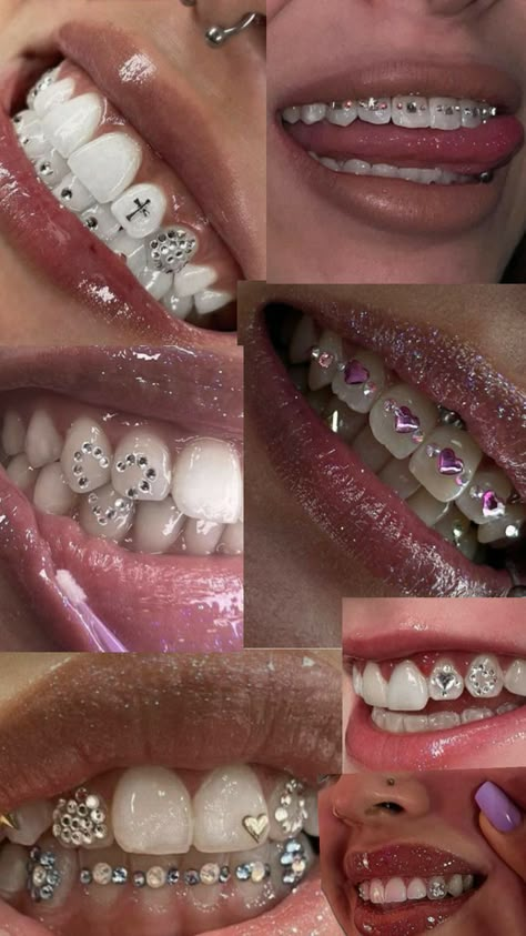 Silver Teeth Aesthetic, Tooth Gems Braces, Teeth Gem Designs, Tooth Gems Design, Strass Teeth, Girly Grillz, Brackets Aesthetic, Teeth Jewels, Teeth Gems Diy