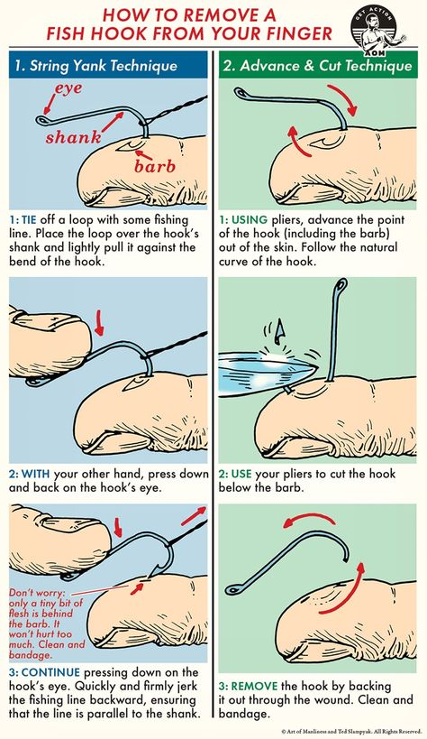 How to Remove a Fish Hook | The Art of Manliness Survival Skills Life Hacks, Art Of Manliness, Survival Life Hacks, Survival Techniques, Fish Hooks, Survival Life, Wilderness Survival, Simple Life Hacks, Camping Survival