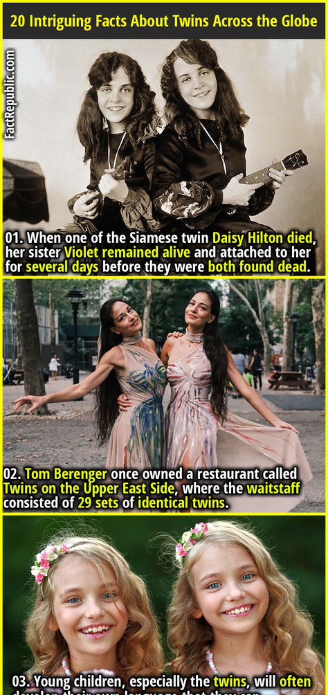 01. When one of the Siamese twin Daisy Hilton died, her sister Violet remained alive and attached to her for several days before they were both found dead. Siamese Twins, Tom Berenger, Twins Sisters, Optical Phenomena, Fact Republic, Ancient History Facts, Facts You Didnt Know, Trivia Facts, Four Sisters