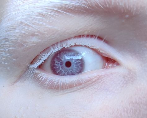 20 People Who Were Gifted With Something Special by Nature People With Green Eyes, Head Anatomy, Teal Eyes, Human Reference, Eyes On The Prize, Face Reference, Eye Photography, Human Anatomy, Eye Art