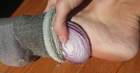 Onion In Sock, Onion In Your Sock, Sistem Saraf, Bolesti Chrbta, Chinese Medicine, Natural Medicine, Alternative Medicine, Herbal Medicine, Health Remedies