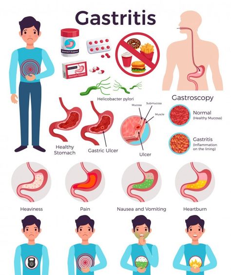 Home Remedy For Ulcers Stomach, Stomach Bacteria, Flat Infographic, Nclex Practice Questions, Healthy Stomach, Gastric Problem, Nclex Questions, Test Plan, Questions With Answers