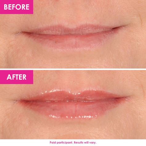 GrandeLIPS Hydrating Lip Plumper Gloss - Grande Cosmetics | Sephora Lip Plumper Gloss, Lip Care Routine, Grande Cosmetics, Plumping Lip Gloss, Lip Products, Lip Plumper, Lip Care, Hyaluronic Acid, High Gloss