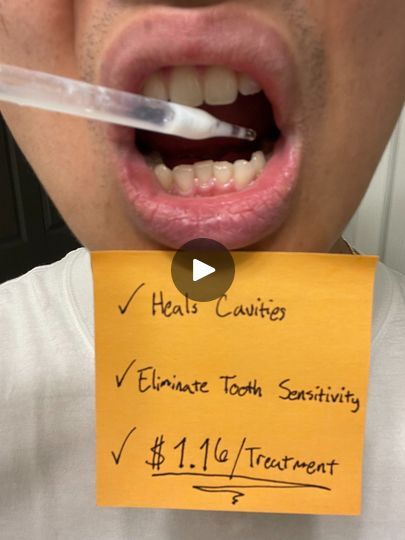 17K views · 853 reactions | Restore Tooth Enamel (Naturally) - Tooth Armor | Just brush it in - and kiss cavities and tooth sensitivity goodbye. Here's how we naturally restore tooth enamel.

There’s a dental breakthrough that is... | By Dentite | Facebook Teeth Enamel Repair, Tooth Enamel Repair, Heal Cavities, 50k Views, Tooth Enamel, Tooth Sensitivity, Cavities, Kiss, Repair