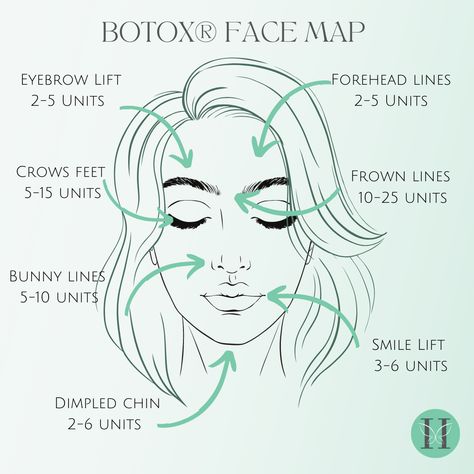 Botox Tips And Tricks, Botox Face Mapping, Botox Units, Botox Areas On Face, Starting A Botox Business, Botox Price List, Botox Mapping, Botox Locations On Face, Botox Supplies