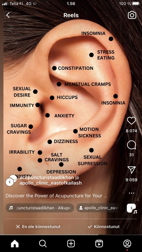 Ear Acupressure, Internal Health, Healing Reflexology, Ear Reflexology, Ear Seeds, Acupressure Therapy, Reflexology Chart, Acupressure Massage, Naturopathic Medicine