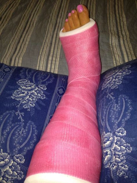 Cast Cast Colors, Long Leg Cast, Leg Cast, Hospital Photos, Book Aesthetics, Broken Leg, Hendrix, It Cast, Collage