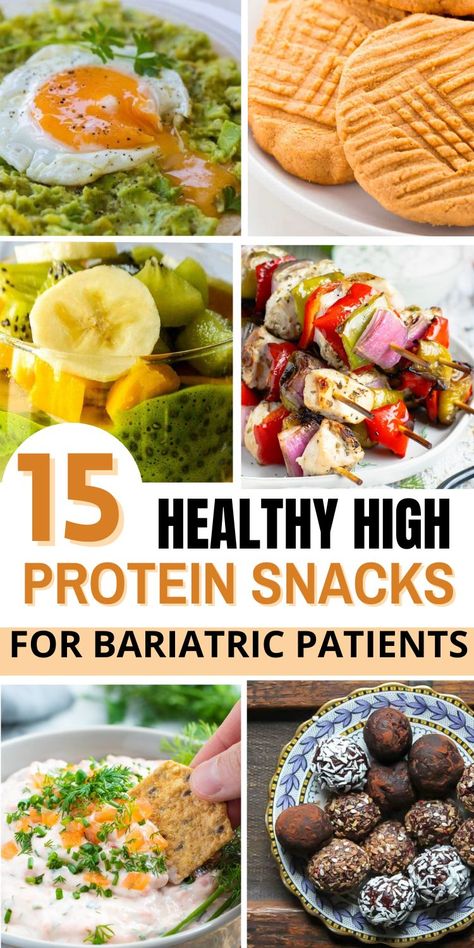 If you have recently had gastric bypass surgery and are looking for healthy snacks to eat, then you need these recipes! These are the best high-protein snacks for people who have had weight loss surgery.Gastric Bypass Snacks.Protein Snacks Recipes.Gastric Bypass Recipes.Healthy High Protein Snacks.Healthy High Protein Snacks Post Gastric Bypass Meal Plan, Gastric Bypass Sleeve Liquid Diet Ideas, Caloric Bypass Diet, Gastric Bypass Sleeve Post Op Liquid Diet, Bypass Surgery Diet Recipes, Bariatric Snack Recipes, Post Op Bariatric Recipes Liquid Diet, Gastric Bypass Snack Ideas, Gastro Bypass Recipes