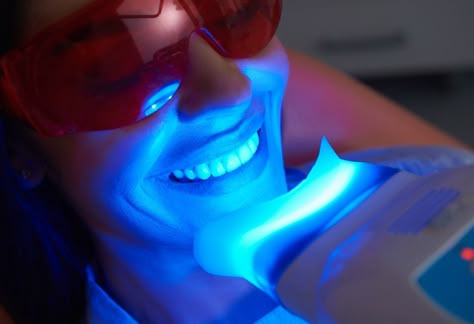 Teeth Whitening Procedure, Laser Teeth Whitening, Teeth Bleaching, Dental Cosmetics, Dental Procedures, Natural Teeth Whitening, Natural Teeth, Krav Maga, Whitening Kit