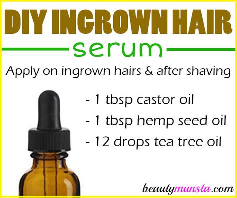 Try this DIY ingrown hair serum if you’re constantly plagued by those pesky little ingrown hairs! Ingrown hairs can creep up on anyone who does hair removal, whether you shave, wax, pluck or whatever, you have a chance of getting ingrown hairs. There are quite a number of ingrown hair remedies such as this DIY … Diy Ingrown Hair Serum, Hair Serum Recipe, Diy Wax Hair Removal, Ingrown Hair Armpit, Diy Hair Serum, Diy Eyelash Growth Serum, Ingrown Hair Serum, Serum Recipe, Ingrown Hair Remedies