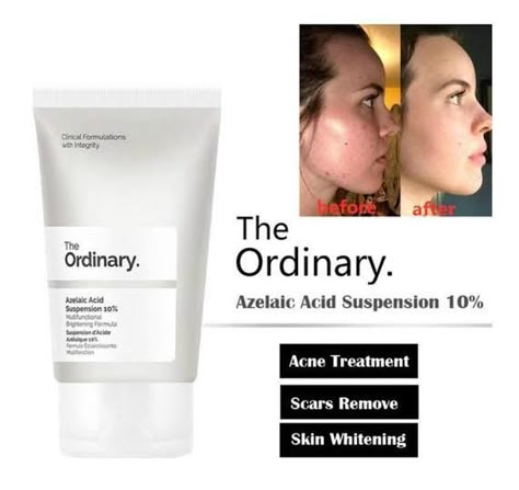 The Ordinary Azelaic Acid, Haut Routine, Skin Care Basics, Natural Face Skin Care, Serious Skin Care, Skin Care Tutorial, Basic Skin Care Routine, Clear Skin Tips, Azelaic Acid