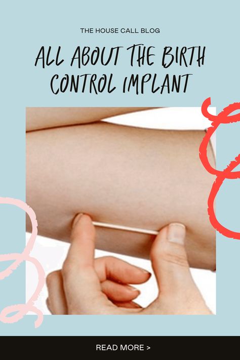 Nexplanon Implant, Birth Control Implant, Stopping Birth Control, Types Of Birth Control, Am I Pregnant, Birth Control Options, Forms Of Birth Control, Birth Control Methods, Hormonal Birth Control