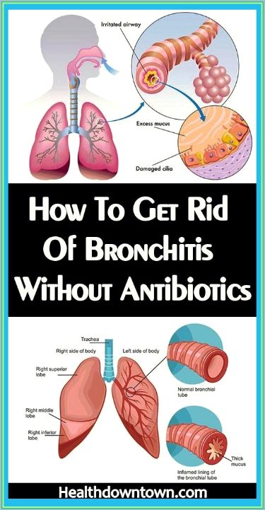 Home Remedies For Bronchitis Bronchitis Home Remedies, Remedies For Bronchitis, Skincare Routine And Products, Remedies For Sinus Infection, Remedy For Sinus Congestion, Clear Your Sinuses, Ruth Jones, Home Remedies For Bronchitis, Home Remedies For Sinus