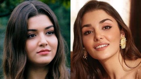 Yüksel Aytuğ criticizes and lists Hande Erçel's plastic surgeries. Turkish columnist in Günaydın Gazetesi (Good Morning Newspaper), Yüksel Aytuğ, has opened up about naming Turkish actress Hande Erçel, 27, the most beautiful woman in the world in 2021 by British magazine, Glamour... Hande Ercel Before, Hande Ercel Surgery, Hands Ercel, Hande Erçel Hair, Morning Newspaper, Hande Ercel Style, The Most Beautiful Woman, Turkish Actress, Turkish Actresses