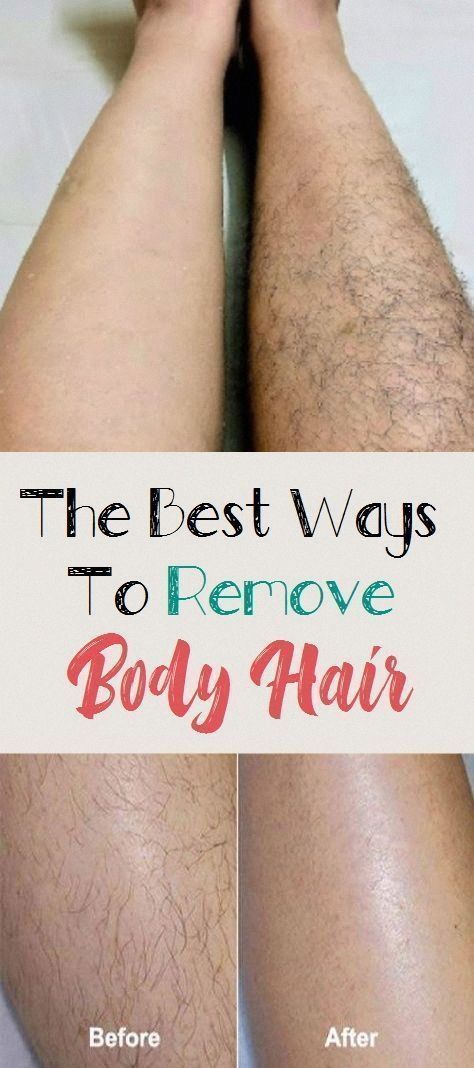 6 Easy Ways to Remove Hair on Legs Younique Skin Care, Leg Hair Removal, Remove Hair, At Home Hair Removal, Women Health Care, Diy Hair Care, Body Hair Removal, Unwanted Hair Removal, Hair Food