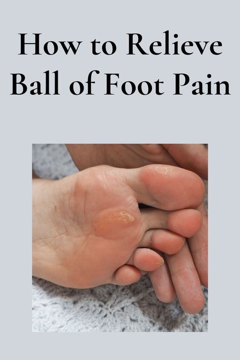 Ball of foot pain can be a frustrating and debilitating issue that affects many people. It can cause discomfort and pain when walking, running, or standing for long periods of time. Fortunately, there are several ways to relieve ball of foot pain and get back to your daily activities. Sore Feet Relief, Foot Pain Chart, Sore Feet Remedies, Foot Pain Relief Remedies, Nerve Pain Remedies, Pain Relief Remedies, Foot Exercises, Healing Remedies, Foot Pain Relief