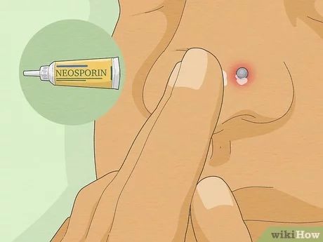 How to Treat an Infected Nose Piercing: 8 Things to Do Nose Piercing Healing Stages, Infected Nose Piercing, Nose Piercing Infection, New Nose Piercing, Nose Infection, Nose Stud Sizes, Nose Piercing Bump, Advanced Cardiac Life Support, Urgent Care Clinic