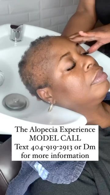 Alopecia Hairstyles Black Women, Bald Spots Women, Alopecia Awareness, Alopecia Hairstyles, Short Weave, Bald Spot, Becoming A Model, Model Call, Hormone Imbalance