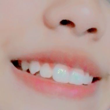 Smile Claim For Dr, Teeth Claim, Canine Teeth Human Aesthetic, Smile With Fangs, Custom Phone Cases Diy, Smile Tips, Cute Teeth, Canine Teeth, Teeth Aesthetic