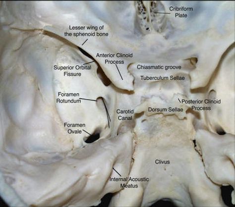 Sella turcica Sphenoid Bone, Skull Anatomy, Cranial Nerves, Brain Anatomy, Muscle Anatomy, Human Anatomy And Physiology, Medical Anatomy, Med School, Neurology