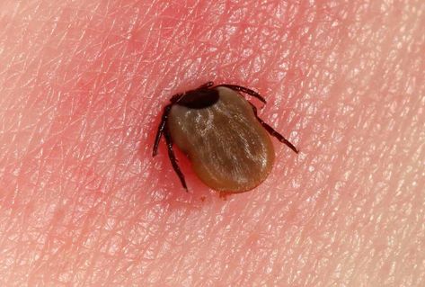 Identifying a Tick Bite From Pictures Tick Bite Rash, Tick Bites Pictures, Fever Rash, Types Of Ticks, Blood Test Results, Tick Bite, Tick Repellent, Facial Nerve, Tick Prevention