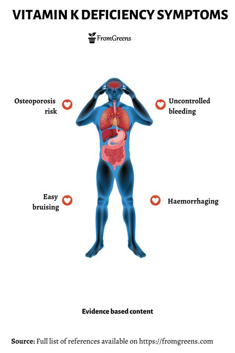 Learn about the deficiency symptoms of vitamin K and low vitamin K side effects. #vitamink #deficiencysymptoms #vitaminknutrition #nutritiontips #diduknow Zinc Deficiency Symptoms, Vitamin D Side Effects, Vitamin D Deficiency Symptoms, Vitamin K Deficiency, Deficiency Symptoms, Zinc Deficiency, B12 Deficiency, Vitamin B12 Deficiency, Human Nutrition