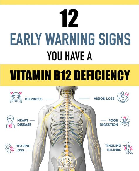 graphic of body with neural system with text - 12 early warning signs you have a vitamin b12 deficiency B12 Deficiency Symptoms, Deficiency Symptoms, B12 Deficiency, Vitamin B12 Deficiency, Vitamin Deficiency, Make Up Inspiration, Vitamin B12, Health Facts, Vitamin B