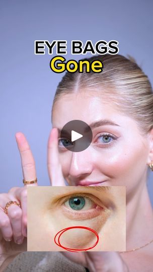 Exercise For Eye Bags, Face Yoga For Under Eye Bags, Exercise For Puffy Eyes, Eye Excercise, How To Grt Rid Of Bags Under Your Eyes, Rid Of Eye Bags, Get Rid Of Eye Bags, Face Fitness, Facial Yoga