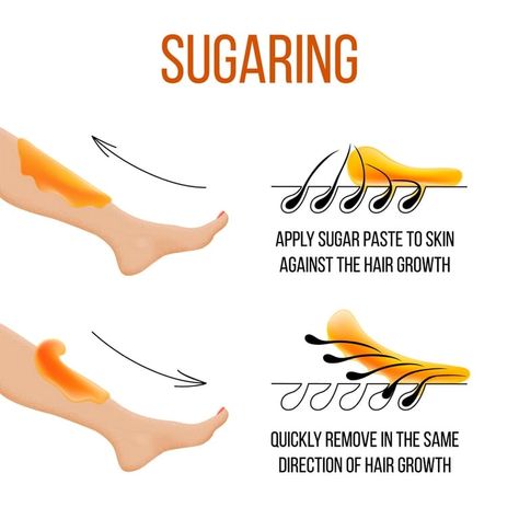 Hair-Removal Techniques: Waxing versus Sugaring Sugar Hair Removal, Natural Hair Removal Remedies, Cryo Facial, Sugaring Hair Removal, Best Hair Removal Products, Sugar Waxing, Excess Hair, Wax Strips, Body Hair Removal