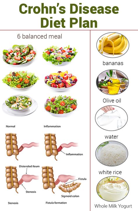 Are you looking for a diet plan to get rid of crohn's disease? Then here's an effective crohns diet plan to follow. Learn how you can include in your routine. Crohns Diet, Crohns Recipes, Reduction Diet, Best Diet Foods, Baking Powder Uses, A Diet Plan, Best Diet Plan, Low Fat Diets, Healthy Diet Plans