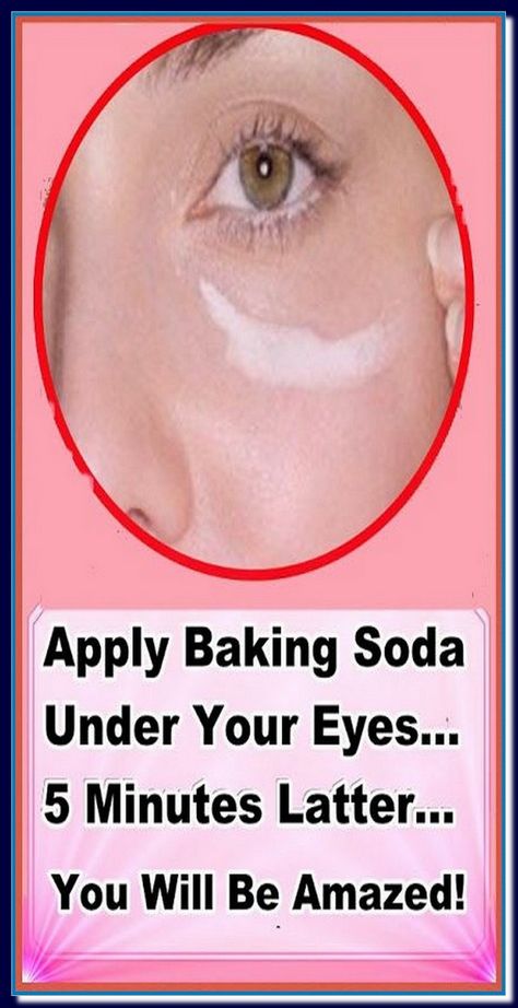 APPLY BAKING SODA UNDER YOUR EYES� 5 MINUTES LATTER� YOU WILL BE AMAZED! Saggy Eyelids, Baking Soda Face Mask, Baking Soda Face, Droopy Eyelids, Baking Soda Benefits, Natural Mask, Remove Dark Circles, Oil Free Moisturizers, Acne Free