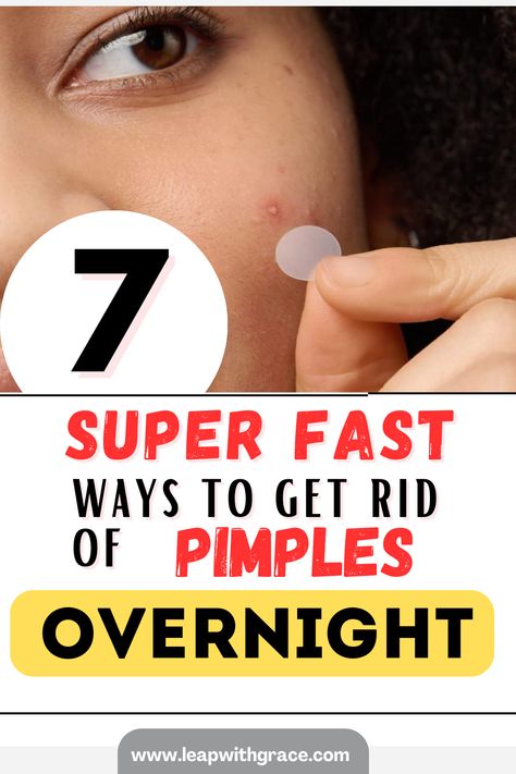 there remedies make it easy for you to get rid of pimples overnight. check out these top rated products and remedies to get rid of youce as fast as possible. Honey And Cinnamon Face Mask, Pimple Hacks, Cinnamon Face Mask, Diy Face Mask For Acne, Skincare Routine For Beginners, Morning Routine Skincare, Get Rid Of Pimples Overnight, Simple Skin Care Routine, Treatments For Acne