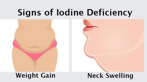 Iodine Supplement Benefits, Iodine Foods, Iodine Deficiency Symptoms, Iodine Benefits, Healthy Tricks, Enlarged Thyroid, I Choose Happy, Iodine Supplement, Thyroid Remedies