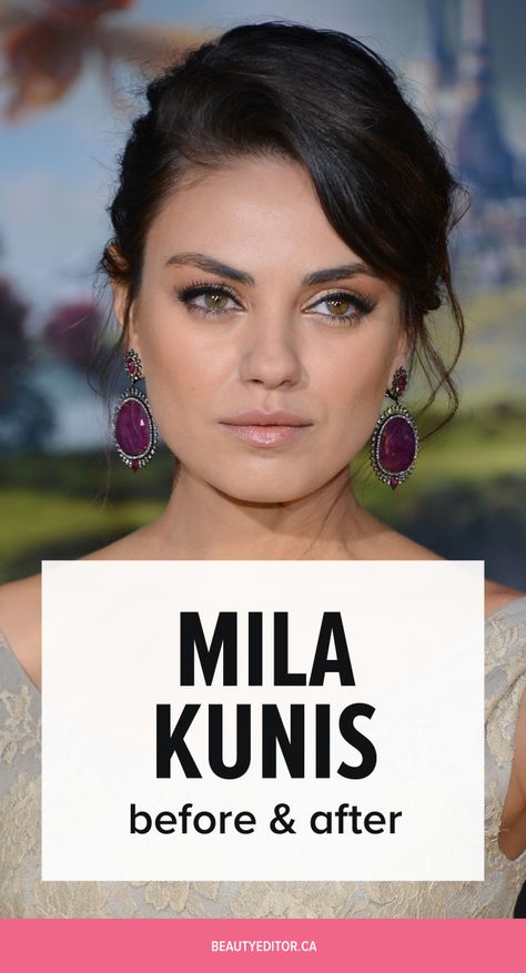 Mila Kunis Eyebrows, Mila Kunis Diet, Mila Kunis Hairstyles, Eye Brow Lift Before And After, Pueraria Mirifica Before And After, Eye Lift Before And After, Before And After Plastic Surgeries, Eyebrow Lift Before And After, Mika Kunis Hair