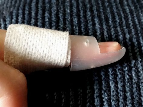 Splinted! Learning to cope with Mallet Finger – The Pathless Wood Mallet Finger Splint, The Pathless, Mallet Finger, Finger Injury, Finger Splint, Unusual Things, Arm Warmers, Things That, Nails