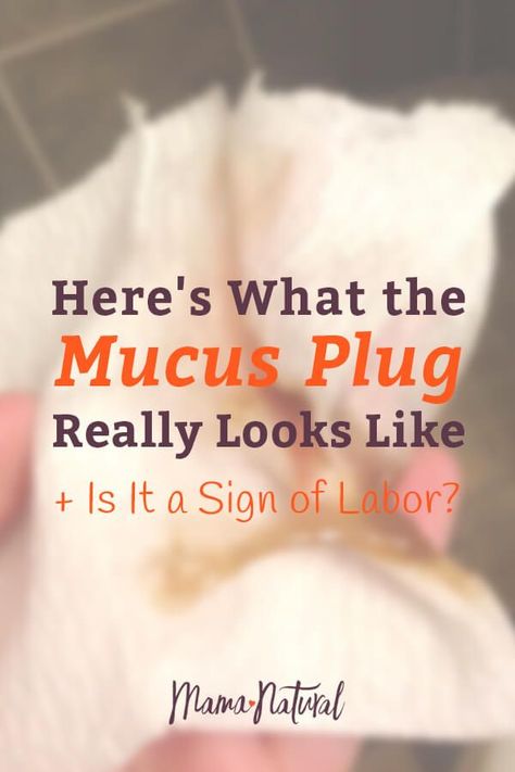 What is a mucus plug? What does a mucus plug look like? Does losing the mucus plug mean that labor is starting? Find out in this article! https://www.mamanatural.com/mucus-plug/ Mucous Plug, Yellow Mucus, Mucus Plug, It Photos, Pregnancy Labor, Mama Natural, Fertility Diet, Nutrition Drinks, Pregnancy Information