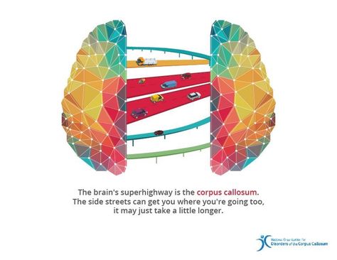 The National Organization of Disorders of the Corpus Callosum (NODCC) Corpus Callosum, Radiology Imaging, Brain Images, Cerebral Cortex, Counseling Psychology, Brain Science, Special Kids, Sensory Processing, Anatomy And Physiology