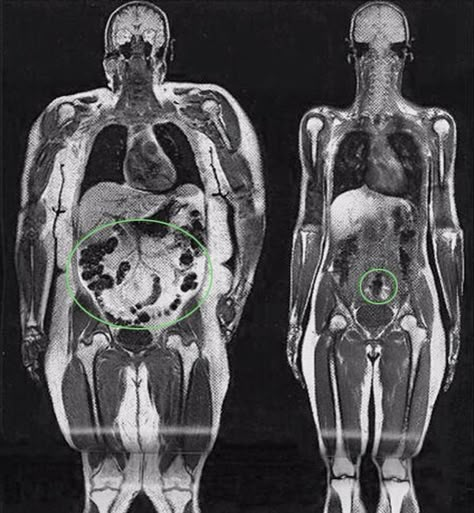 Big Boned, Human Body Anatomy, Human Anatomy Art, Medical Anatomy, Body Anatomy, Medical Illustration, Anatomy And Physiology, Radiology, Anatomy Reference