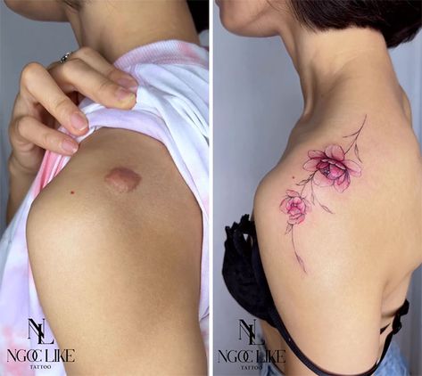 Scar Cover Up Tattoo, Vietnamese Tattoo, Birthmark Tattoo, Burn Tattoo, Red Flower Tattoos, Cover Up Tattoos For Women, Tattoo Over Scar, Scar Cover Up, Tattoos To Cover Scars