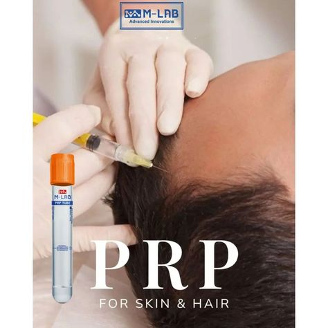 Do you know about M-LAB PRP Tubes and kit ? Consider a healing remedy sourced from the innate curative capabilities of your body. M-LAB PRP injection, with its innovative applications in specialties like PRP Ophthalmology, dermatology,and hair rejuvenation with M-LAB PRP Tubes, is attracting attention in the medical field. This article explores M-LAB PRP Tubes And kit platelet-rich plasma, revealing its amazing benefits and various applications. For those interested in the latest medical i... Prp Injection, Wedding Skin, Laser Peel, Prp Therapy, Prp Hair, Facial Fillers, Platelet Rich Plasma, For Educational Purposes Only, Cream Face