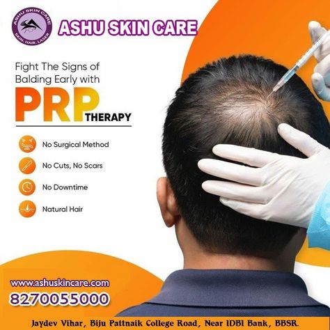 Prp For Hair Growth, Hair Prp Before And After, Prp Hair Therapy Before And After, Hair Transplant Creative Ads, Prp For Hair, Prp Therapy, Hair Implants, Dental Posts, Prp Hair