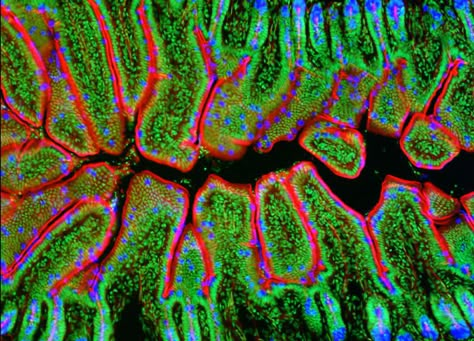 Fluorescence Microscopy | Nikon MicroscopyU | Fluorescence Microscopy Digital Image Gallery Gnome Hands, Pa Aesthetic, Microscopic Art, Microscope Photography, Aesthetic Science, Fluorescence Microscopy, Bell Labs, Plant Cells, Microscopic Photography