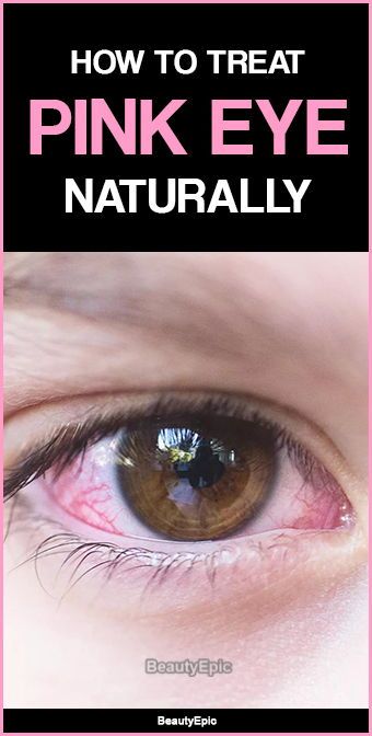 Pink Eye Remedies For Pink Eye, Treating Pink Eye, Pinkeye Remedies, Diy Herbal Remedies, Pink Eye, Natural Cold Remedies, Natural Cough Remedies, Cough Remedies, Cold Remedies