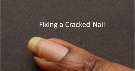 Cracked Nail Repair, How To Fix A Cracked Nail, Fix Cracked Nail, Fix Broken Nail, Cracked Nails, Nail Repair, Nail Bed, New Nail Polish, New Nail Art