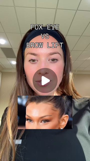 Brett, APRN NP-C • Atlanta injector on Instagram: "What’s your go to?   I love having options I personally opt for the traditional brow lift since I like the little arch in my brow but that’s just personal preference! Lmk your fav ❤️  Follow @injector_brett for more content like this 🫶  …  #browliftbotox #eyebrowlifting #foxeye #atlantabotox #injector" Eye Brow Lift Before And After, Fox Eye Thread Lift Before And After, Brow Lift Botox Before And After, Check Filler Before And After, Botox For Eyebrow Lift, Fox Eye Botox Before And After, Botox Eye Lift, Botox For Hooded Eyes, Nose Botox Before And After