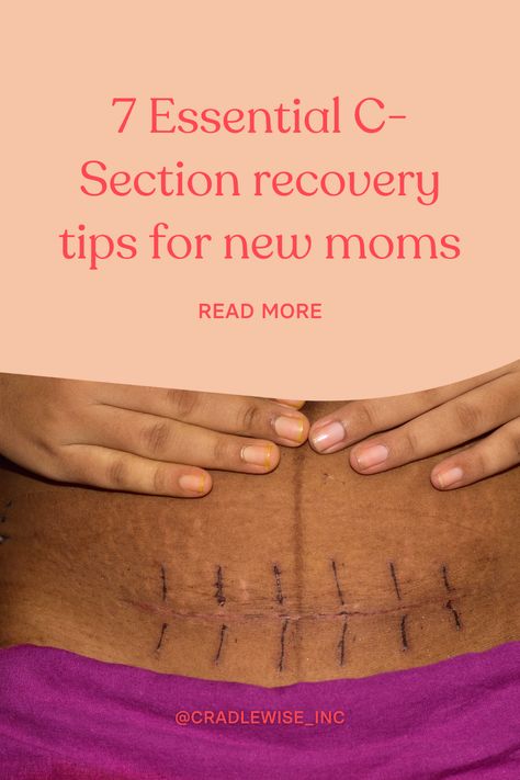 If you're recovering from a C-section, these tips can help you recover faster and get back to your daily routine. Learn how to take care of yourself and heal properly after a C-section with this helpful guide. 3 Weeks Postpartum, Tips For New Moms, C Section Recovery, Abdominal Surgery, C Section, Postpartum Recovery, Mental And Emotional Health, Breast Pumps, How To Take