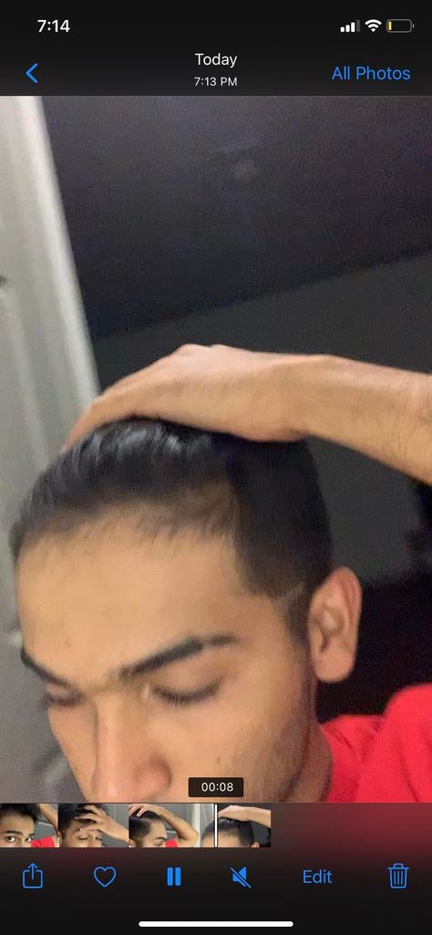 Yo am I balding or is this just a bad hairline - ThorGift.com - If you like it please buy some from ThorGift.com Bad Hairline, A Bad, Mens Hairstyles, Fitbit, Smart Watch, Hair