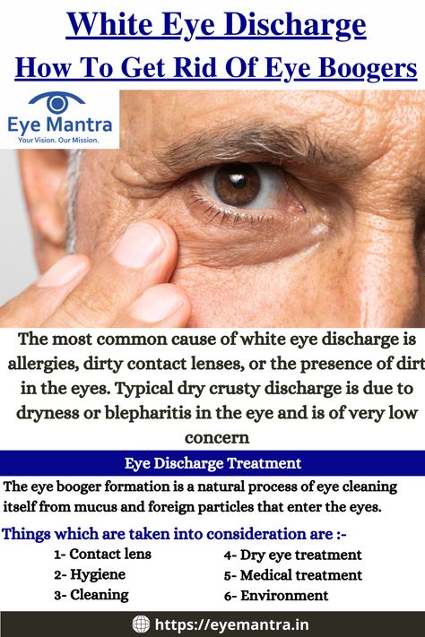 white discharge from eye | How To Get Rid Of Eye Boogers| stringy white mucus in eye | white stuff in corner of eye | white sticky discharge from eye | 	white substance in the eye | White Eye Discharge Crusty Eyes, Eye Infections, In The Corner, White Eyes, Dry Eyes, Yellow Eyes, Eye Care, Allergies, Eyelashes