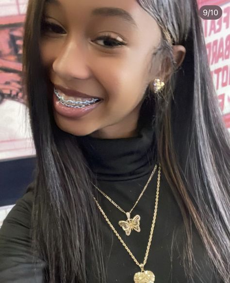 Pretty Girls With Braces Blonde Hair, Braces On Black Girls, Black Girls With Braces, Light Blue Braces, Brace Colors, Blue Braces, Pink Braces, Green Braces, Girls With Braces